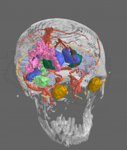 label_tissue_3d